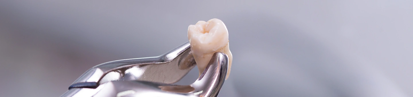 Dental Crowns in Twin Falls, ID