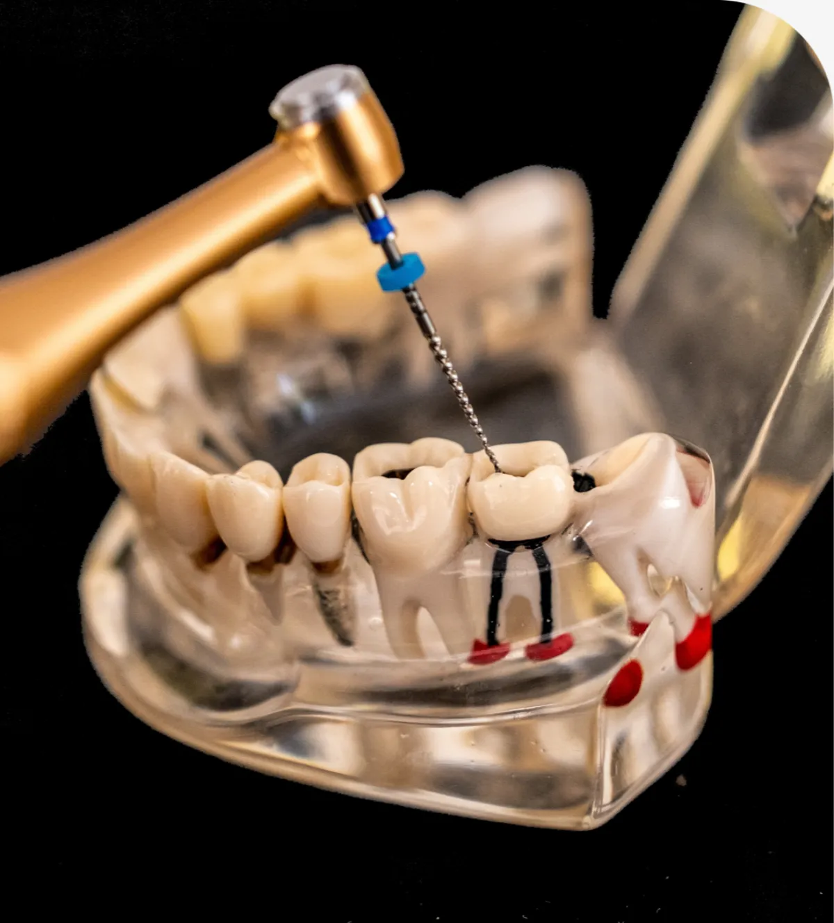 Dental Fillings in Twin Falls, ID