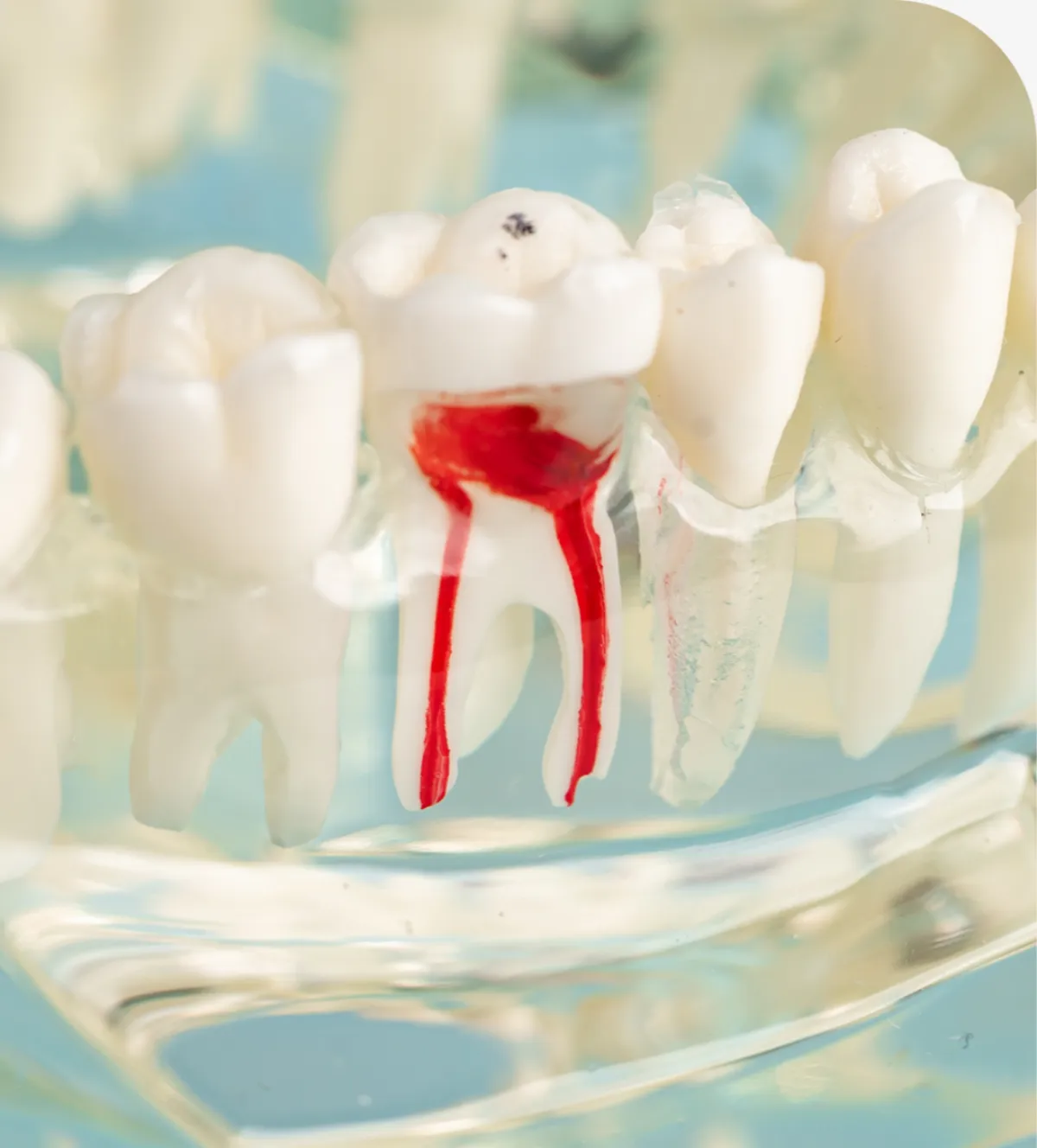 Nonsurgical Gum Disease Treatment in Twin Falls, ID