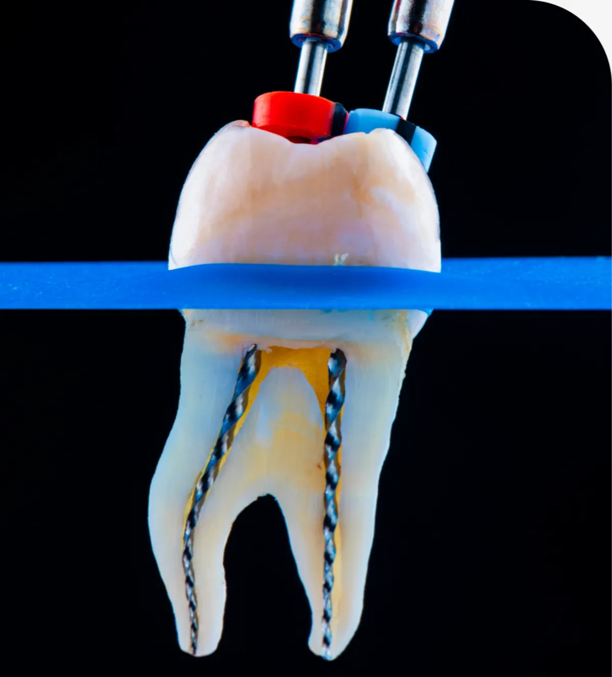 Restorative Dentistry in Twin Falls, ID